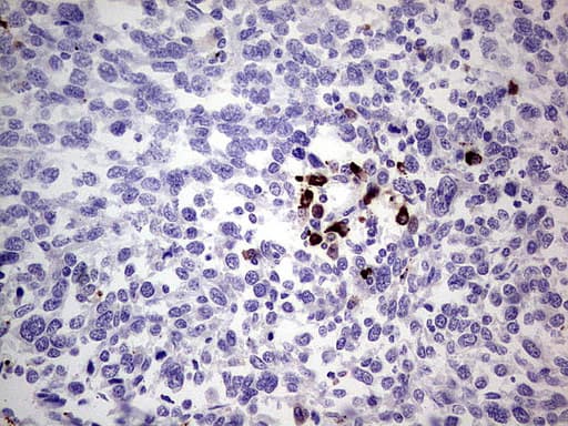 Monoclonal Mouse anti-Human GLI / GLI1 Antibody (clone UMAB170, Carrier-free, aa1-410, IHC, IF, WB)