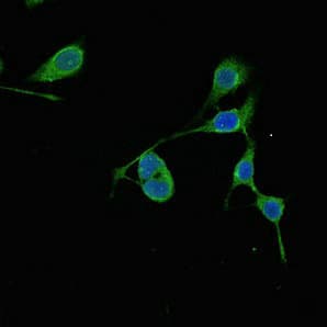 Polyclonal Rabbit anti-Human RMND1 Antibody (IHC, IF, WB)