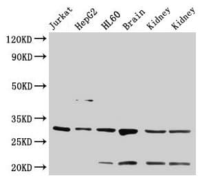 14-3-3 Alpha + Beta Antibody