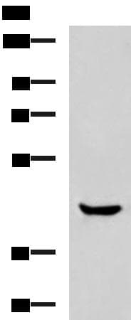 HOXA2 Antibody