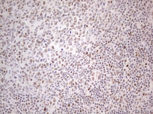 TP53BP1 / 53BP1 Antibody (aa1-300, clone OTI5E1)