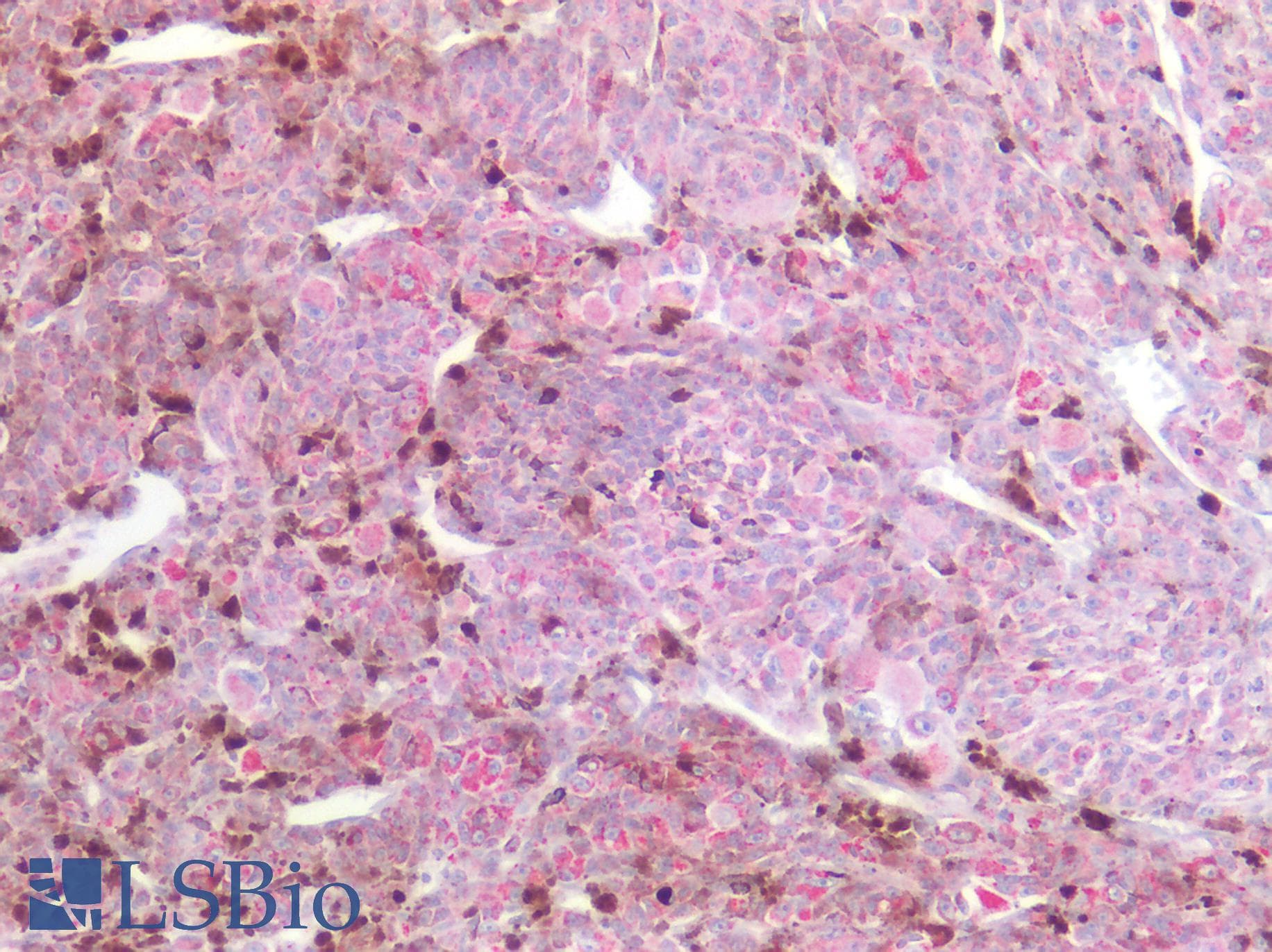 PathPlus™ Polyclonal Rabbit anti-Human GNAQ Antibody (IHC)