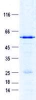 Human IER2 Protein (Recombinant GST, N-terminus + His, C-terminus)