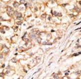 GJD2 / CX36 / Connexin 36 Antibody (aa291-321)
