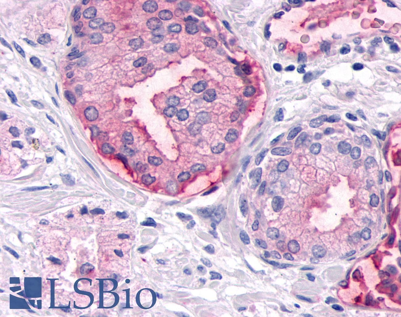 PathPlus™ Polyclonal Rabbit anti-Human DUSP26 / MKP8 Antibody (Internal, IHC)