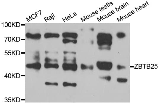 Polyclonal Rabbit anti-Human ZBTB25 Antibody (IHC, IF, WB)
