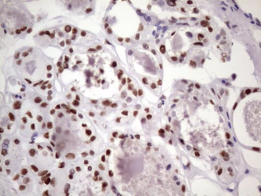 NUDT21 Antibody (aa2-227, clone OTI13H1)