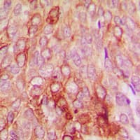 Polyclonal Rabbit anti-Human SERPINB5 / Maspin Antibody (Internal, IHC, IF, WB)