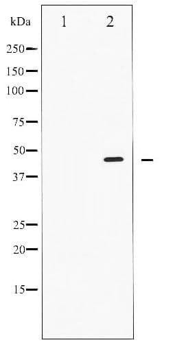 SMAD2+3 Antibody (phospho-Thr8)