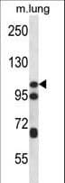 CTNND2 / Delta-2 Catenin Antibody (aa1131-1159)