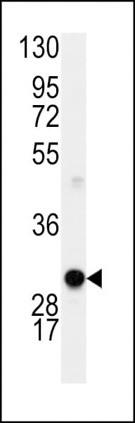 IHC-plus™ CCND1 / Cyclin D1 Antibody (aa68-97)