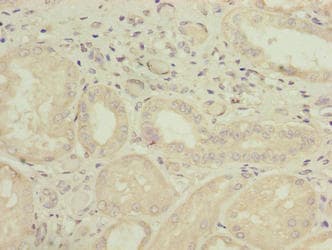 Polyclonal Rabbit anti-Human GALNT15 / GALNTL2 Antibody (IHC, WB)