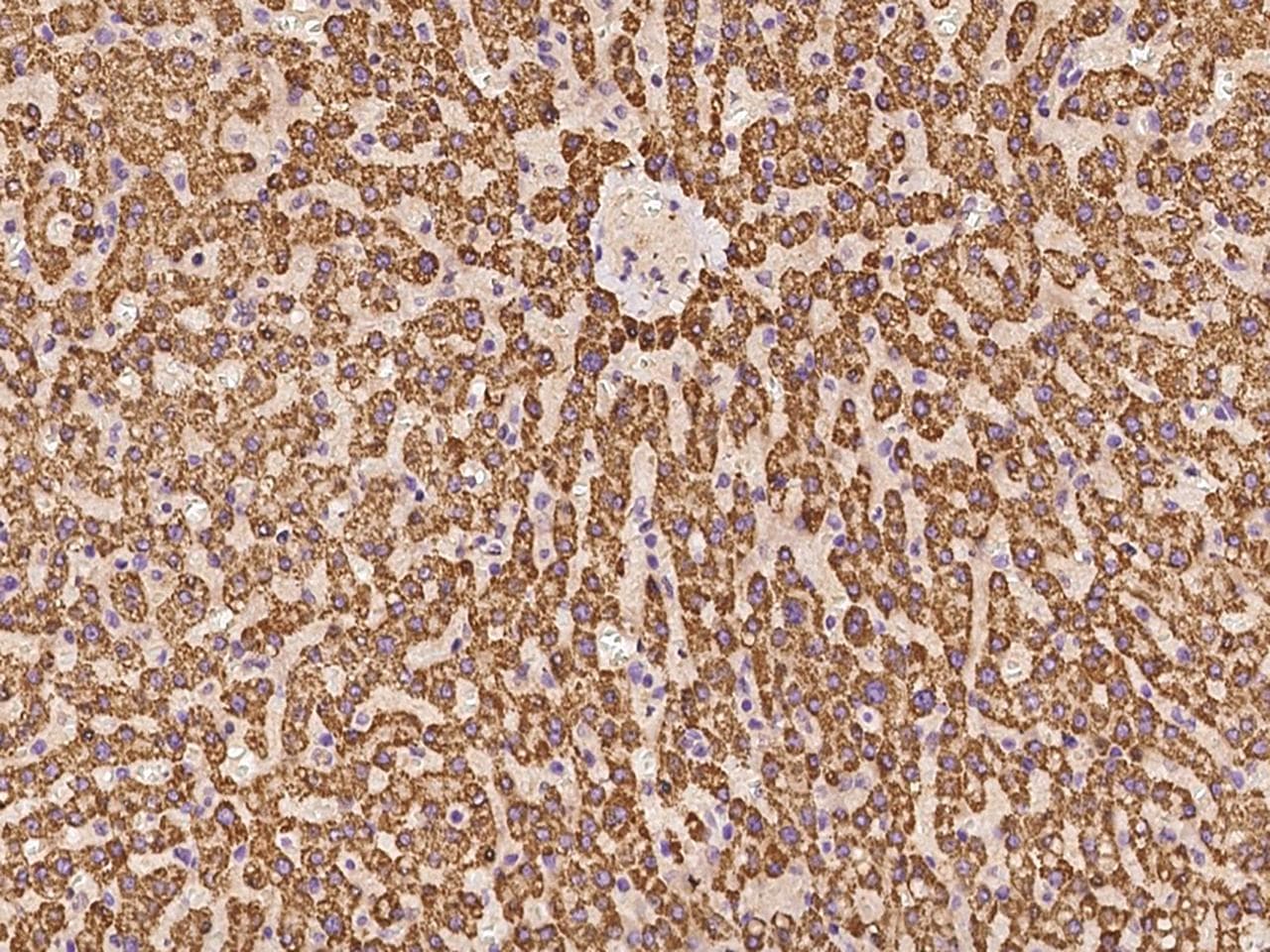 Polyclonal Rabbit anti-Human ACADSB Antibody (IHC, WB)