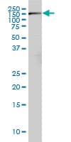 IHC-plus™ Monoclonal Mouse anti-Human RICTOR Antibody (clone 1F3, IHC, WB)