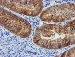FBXO21 Antibody (clone OTI5H4)