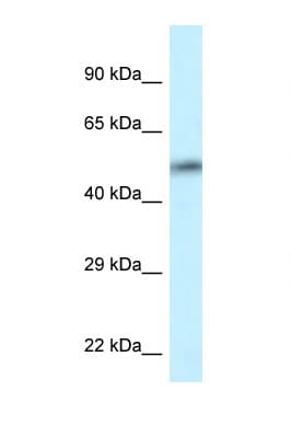 CAMK2D / CaMKII Delta Antibody (aa302-351)