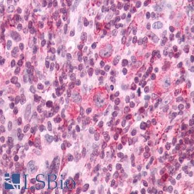 PathPlus™ APLNR/ Apelin Receptor / APJ Antibody (Cytoplasmic Domain)