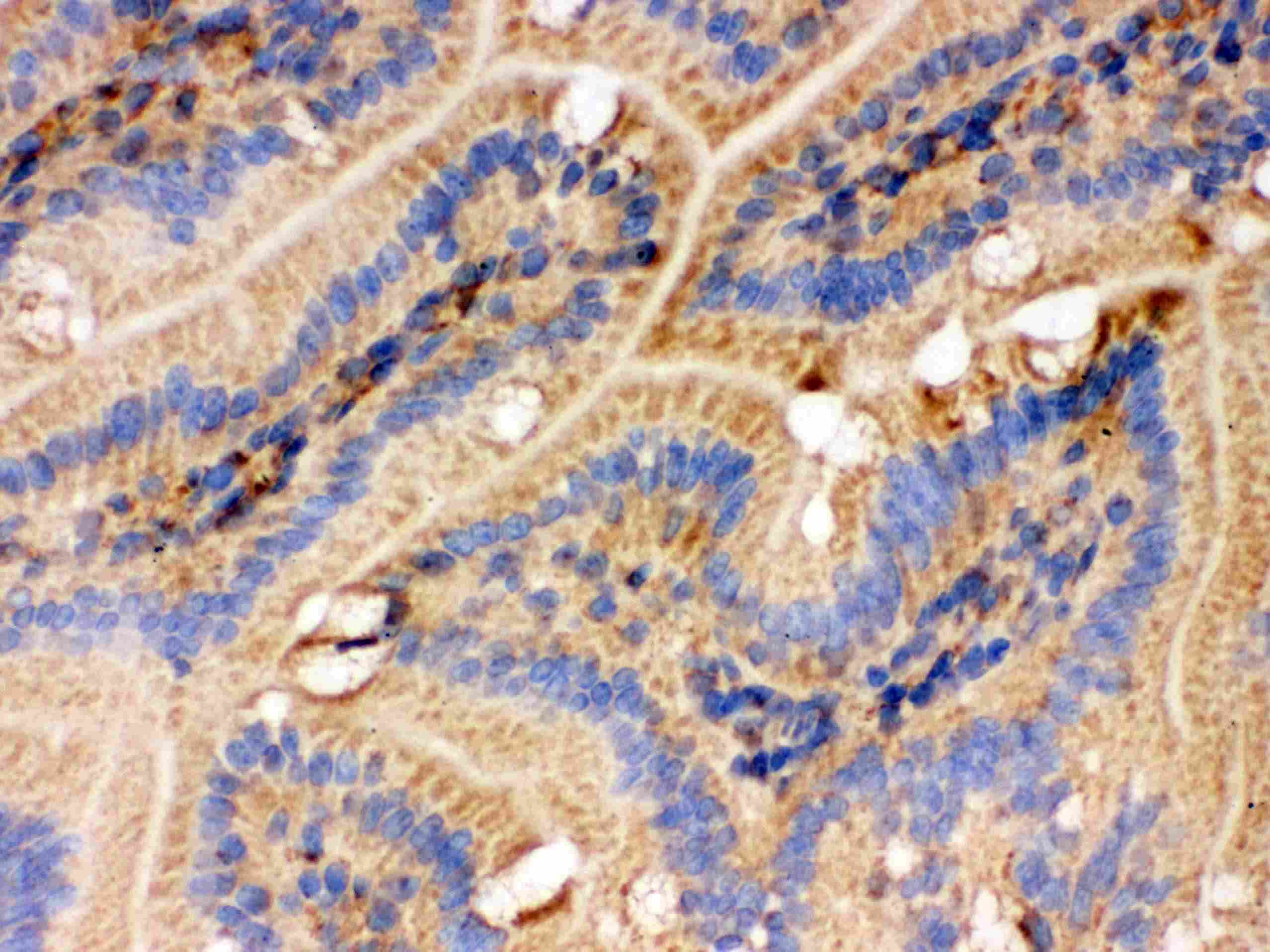 IDH2 Antibody (aa413-447)
