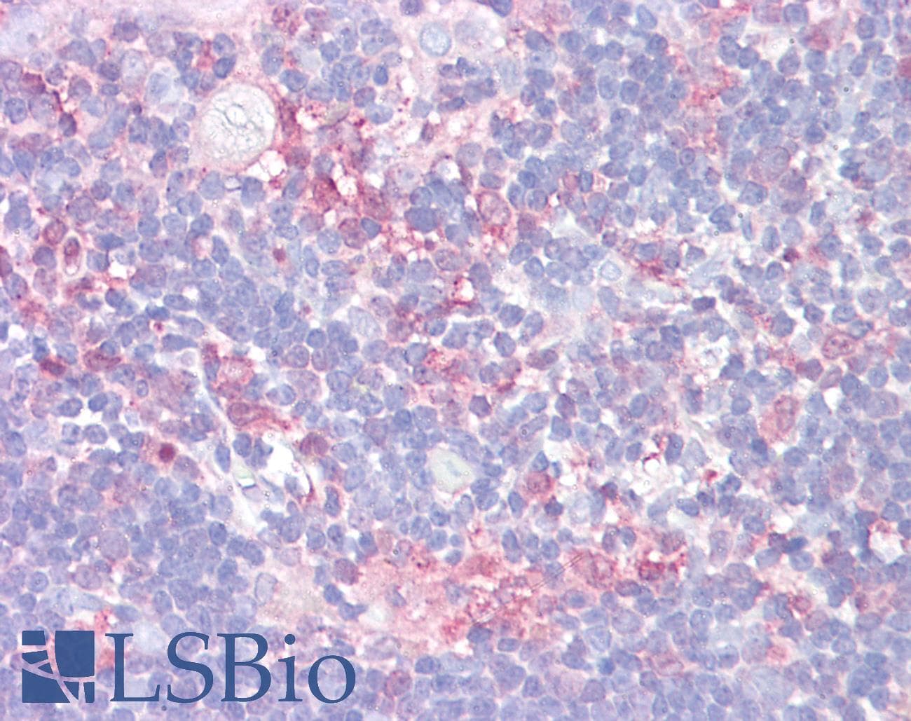 IHC-plus™ Polyclonal Rabbit anti-Human LGALS9 / Galectin 9 Antibody (aa51-100, IHC, IF, WB)