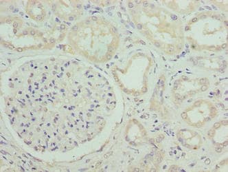 SUSD6 / KIAA0247 Antibody
