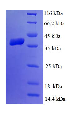 Human LIAS / LIP1 Protein (Recombinant His)