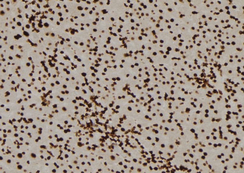 Polyclonal Rabbit anti-Human PPP3CA / CCN1 / Calcineurin A Antibody (IHC, WB)