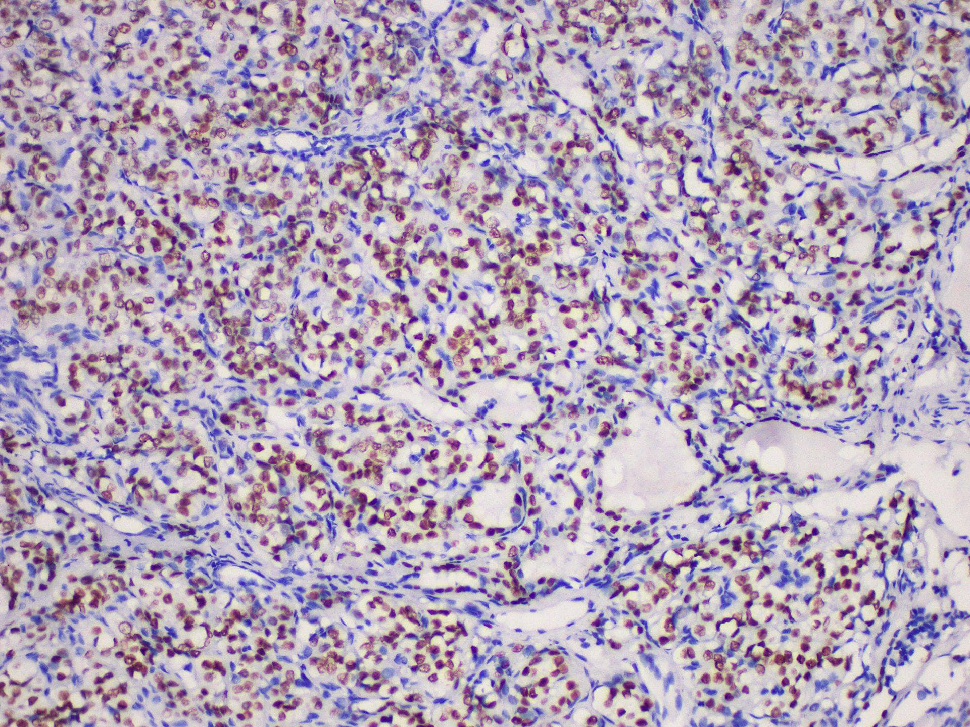 NKX2-1 / Thyroid-Specific TF Antibody