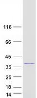 Human Rhodanese / TST Protein (Recombinant Myc-DDK (Flag))