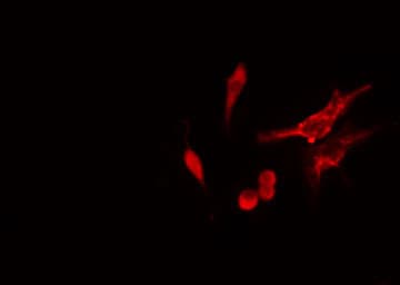 RPS11 / Ribosomal Protein 11 Antibody