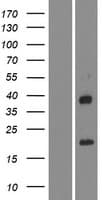 Human IGFL4 Protein (Over-Expression Lysate Myc-DDK (Flag))