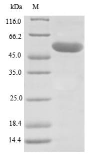 Human LOXL1 Protein (Recombinant)