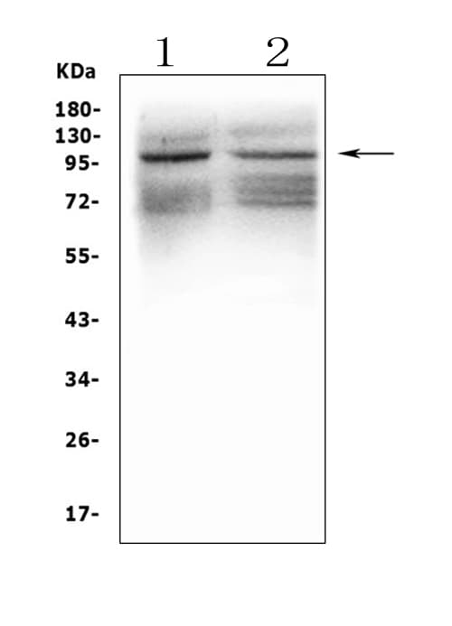 Polyclonal Rabbit anti-Human GRIK1 / GLUR5 Antibody (aa271-450, WB)