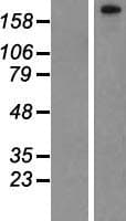 PHF3 Protein (Over-Expression Lysate Myc-DDK (Flag))