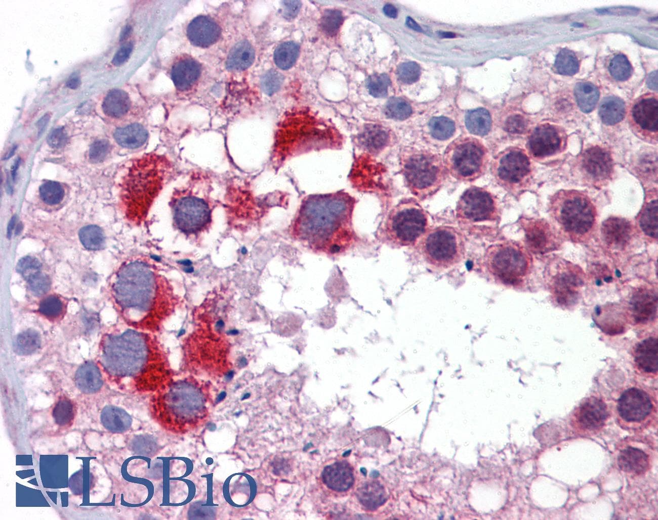 Polyclonal Rabbit anti-Human MTL5 / TESMIN Antibody (aa51-100, IHC, WB)