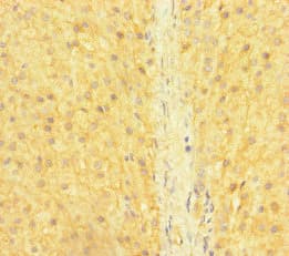 Polyclonal Rabbit anti-Human SNX14 Antibody (IHC, IF)