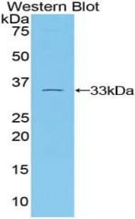 TUBB1 / Tubulin Beta 1 Antibody (aa182-437)