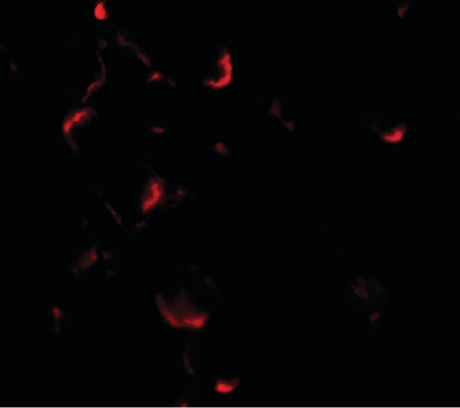 Polyclonal Rabbit anti-Human BCL2L11 / BIM Antibody (IF, WB)