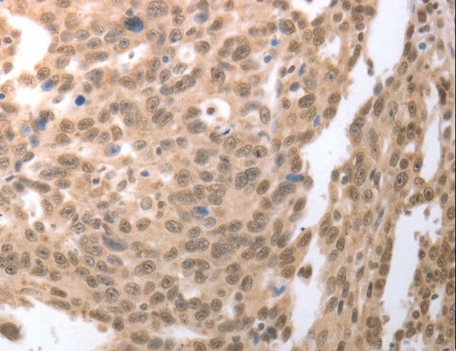 RAD52 Antibody
