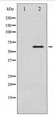 Polyclonal Rabbit anti-Human SMAD1 Antibody (IHC, WB)