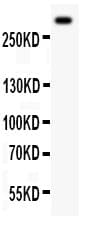 VWF / Von Willebrand Factor Antibody (aa1304-1452)