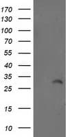 Monoclonal Mouse anti-Human ABRI / ITM2B Antibody (clone OTI1C11, IHC, WB)