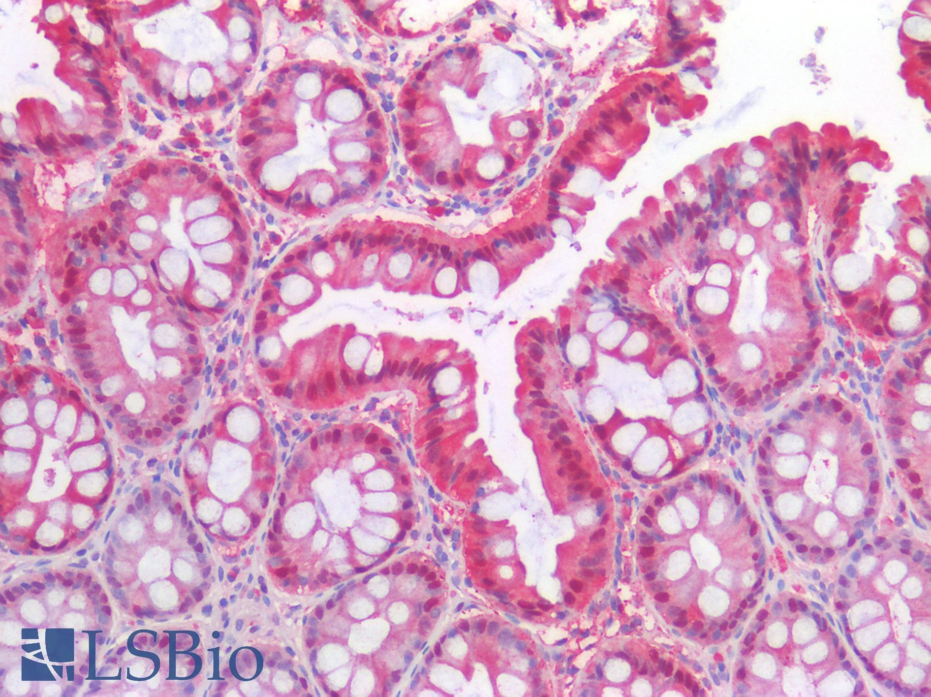 IHC-plus™ ERBB3 / HER3 Antibody