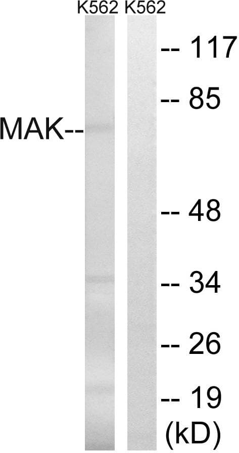 Polyclonal Rabbit anti-Human MAK Antibody (Ab-159, WB)