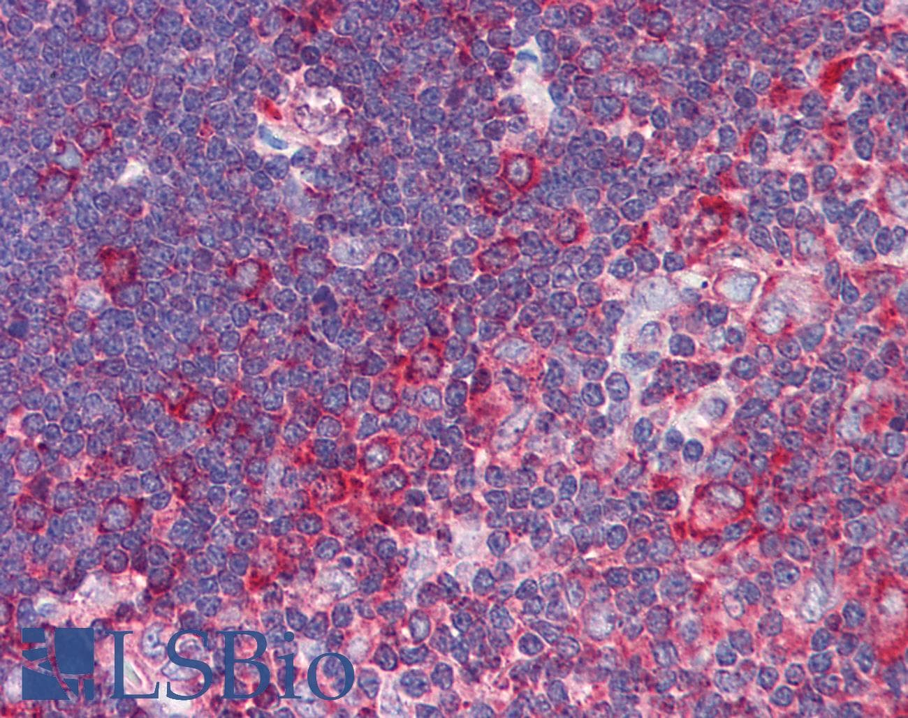 IHC-plus™ Polyclonal Rabbit anti-Human TNFRSF10A / DR4 Antibody (IHC, IF, WB)