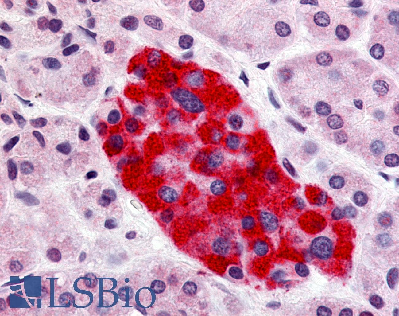 IHC-plus™ Polyclonal Rabbit anti-Human GPR55 Antibody (Cytoplasmic Domain, IHC)