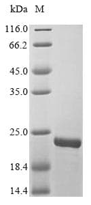 Vaccinia Virus Smallpox-A27L Protein (Recombinant 10His, N-terminus + Myc, C-terminus)