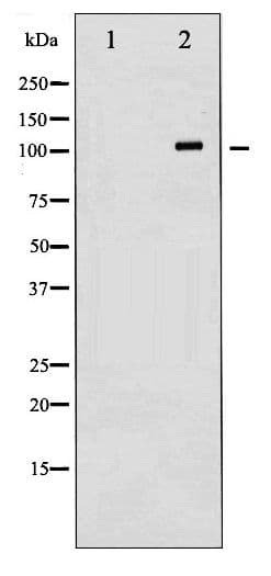 Polyclonal Rabbit anti-Human CD144 / CDH5 / VE Cadherin Antibody (phospho-Tyr731, IHC, WB)