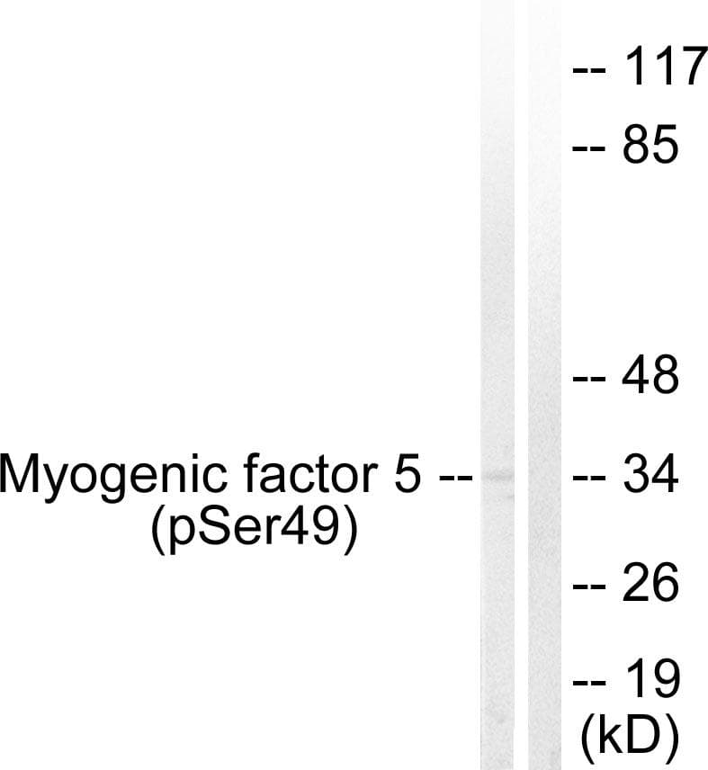 Polyclonal Rabbit anti-Human MYF5 / MYF 5 Antibody (phospho-Ser49, WB)