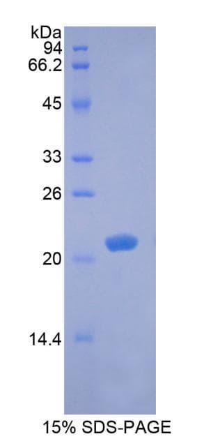 Rabbit BDNF Protein (Recombinant His)