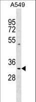 IHC-plus™ Polyclonal Rabbit anti-Human PPT1 / CLN1 Antibody (aa189-217, IHC, WB)